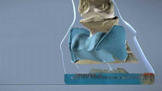 représentation de l'anatomie du sabot et du ferrage composite - composants flexibles en bleu