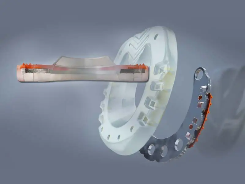 ferrure hybride - structure composée d'un noyau métallique et d'une enveloppe en plastique