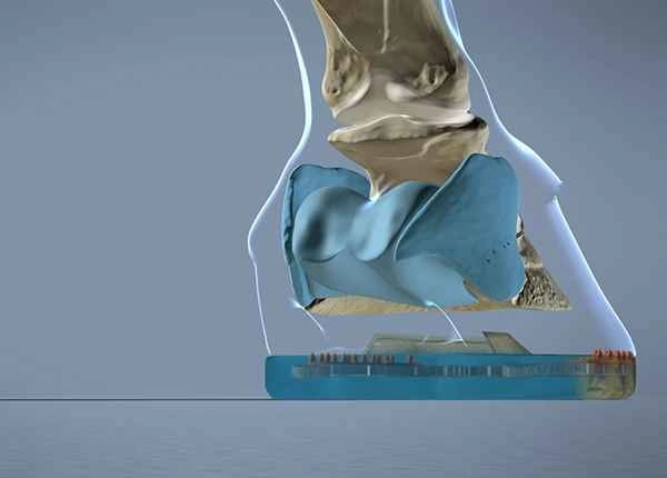 Man sieht anhand der Anatomie des Pferdehufes, dass die flexiblen reinen Kunststoffbereiche des Verbundhufeisens im Bereich der weichen Strukturen des Hufes liegen. Der Beschlag basiert auf der Hufanatomie.